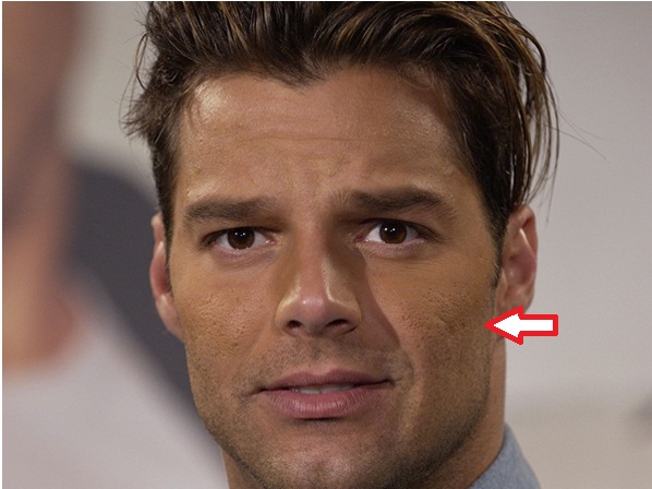 Las 15 imperfecciones que más esconden los famosos - 11. Ricky Martin tiene cicatrices del acné